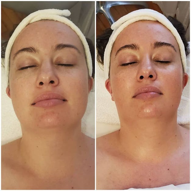 Fresh - Mild Rice Facial Cleanser